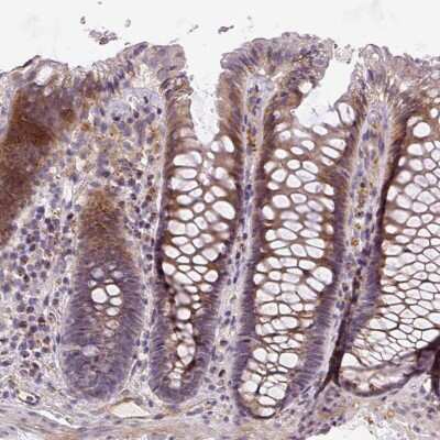 Immunohistochemistry-Paraffin: RNF170 Antibody [NBP2-31006]