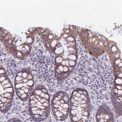 Immunohistochemistry-Paraffin: RNF170 Antibody [NBP2-48986]