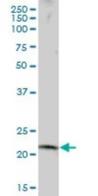 Western Blot: RNF170 Antibody [H00081790-B01P]