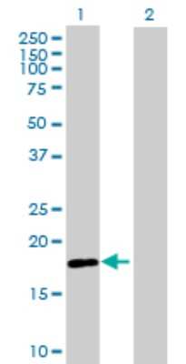 Western Blot: RNF170 Antibody [H00081790-B01P]