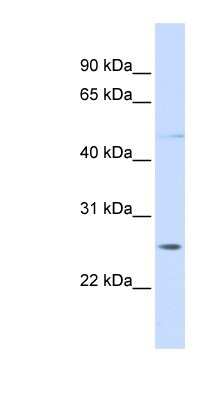 Western Blot: RNF170 Antibody [NBP1-59390]