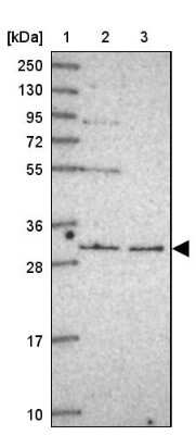 Western Blot: RNF170 Antibody [NBP2-48986]