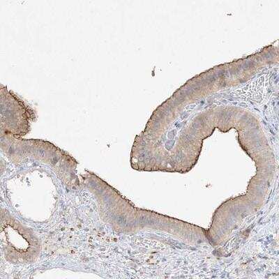 Immunohistochemistry-Paraffin: RNF175 Antibody [NBP1-83507]