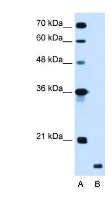 Western Blot: RNF175 Antibody [NBP1-55079]