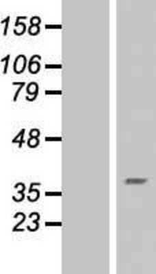 Western Blot: RNF175 Overexpression Lysate [NBL1-15436]