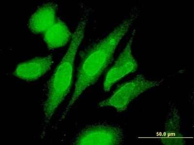 Immunocytochemistry/ Immunofluorescence: RNF180 Antibody (1C4) [H00285671-M05]