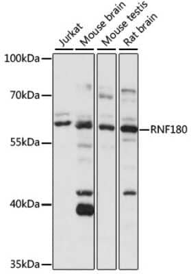 Western Blot: RNF180 AntibodyAzide and BSA Free [NBP3-04720]