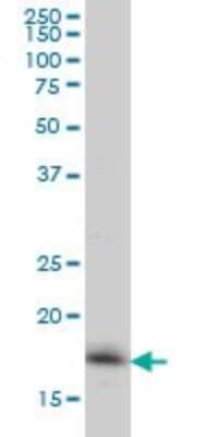 Western Blot: RNF181 Antibody (5A7) [H00051255-M01]