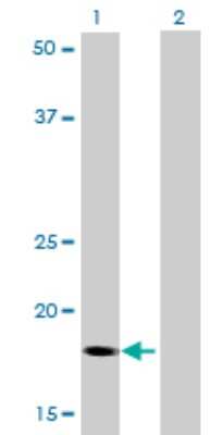 Western Blot: RNF181 Antibody (5A7) [H00051255-M01]