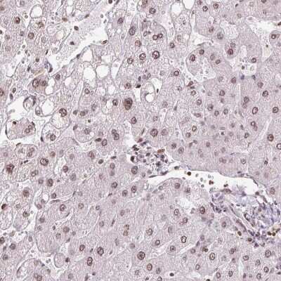 Immunohistochemistry: RNF181 Antibody [NBP2-49357]