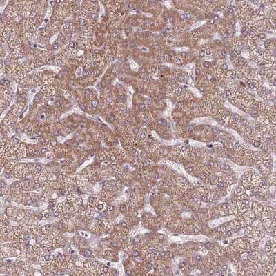 Immunohistochemistry-Paraffin: RNF181 Antibody [NBP2-13240]