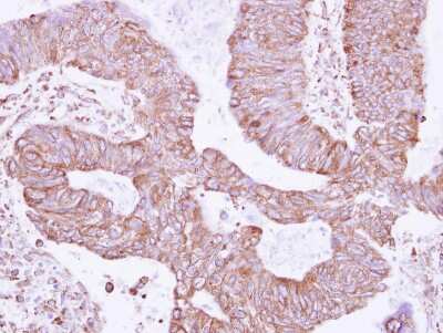 Immunohistochemistry-Paraffin: RNF181 Antibody [NBP2-20181]