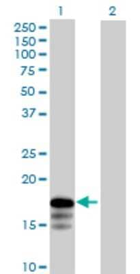 Western Blot: RNF181 Antibody [H00051255-B01P]