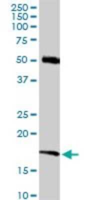 Western Blot: RNF181 Antibody [H00051255-D01P]