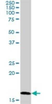 Western Blot: RNF181 Antibody [H00051255-D01P]