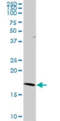 Western Blot: RNF181 Antibody [H00051255-D01P]