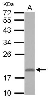 Western Blot: RNF181 Antibody [NBP2-20181]