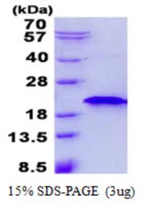 SDS-PAGE: Recombinant Human RNF181 His Protein [NBP2-23439]