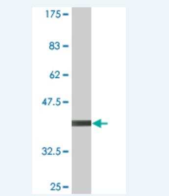 Western Blot: RNF182 Antibody (2D8) [H00221687-M03]