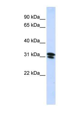 Western Blot: RNF182 Antibody [NBP1-59762]