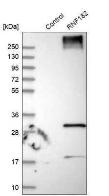 Western Blot: RNF182 Antibody [NBP1-82707]