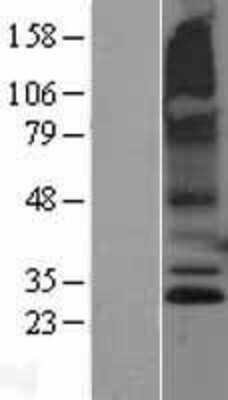 Western Blot: RNF182 Overexpression Lysate [NBL1-15438]