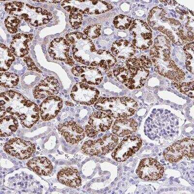 Immunohistochemistry-Paraffin: RNF183 Antibody [NBP2-31683]