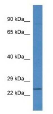 Western Blot: RNF183 Antibody [NBP1-74192]