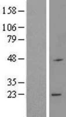 Western Blot: RNF183 Overexpression Lysate [NBL1-15439]