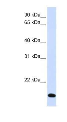 Western Blot: RNF185 Antibody [NBP1-59761]