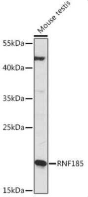 Western Blot: RNF185 AntibodyAzide and BSA Free [NBP2-93917]