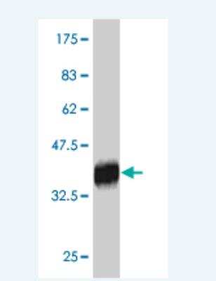 Western Blot: RNF186 Antibody (4F10) [H00054546-M01]