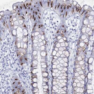Immunohistochemistry: RNF186 Antibody [NBP2-38256]