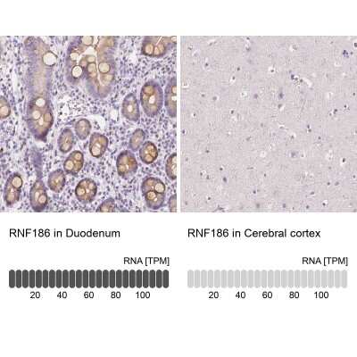 Immunohistochemistry-Paraffin: RNF186 Antibody [NBP1-83667]