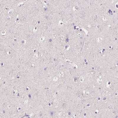 Immunohistochemistry-Paraffin: RNF186 Antibody [NBP1-83667]