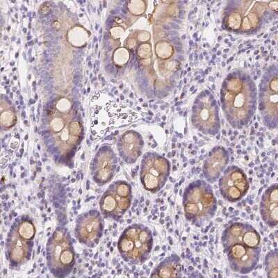 Immunohistochemistry-Paraffin: RNF186 Antibody [NBP1-83667]