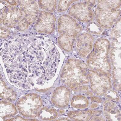 Immunohistochemistry-Paraffin: RNF186 Antibody [NBP1-83667]