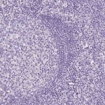 Immunohistochemistry-Paraffin: RNF186 Antibody [NBP1-83667]