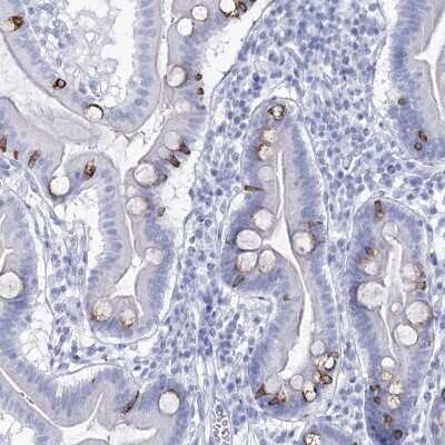 Immunohistochemistry-Paraffin: RNF186 Antibody [NBP2-38256]