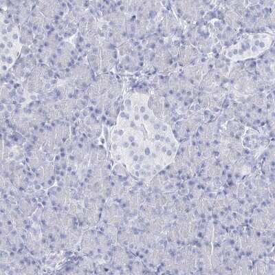 Immunohistochemistry-Paraffin: RNF186 Antibody [NBP2-38256]