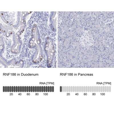 Immunohistochemistry-Paraffin: RNF186 Antibody [NBP2-38256]