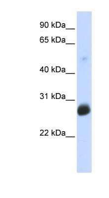 Western Blot: RNF186 Antibody [NBP1-59774]