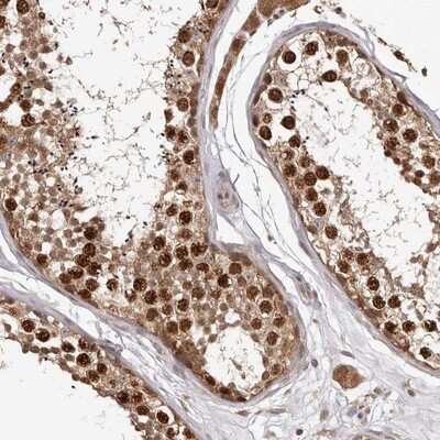 Immunohistochemistry-Paraffin: RNF187 Antibody [NBP1-91025]