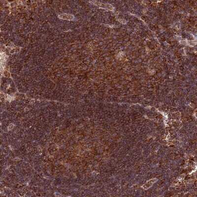Immunohistochemistry-Paraffin: RNF19B Antibody [NBP2-14688]