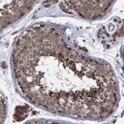 Immunohistochemistry-Paraffin: RNF19B Antibody [NBP3-17429]