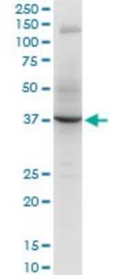 Western Blot: RNF2 Antibody (2B6) [H00006045-M05]