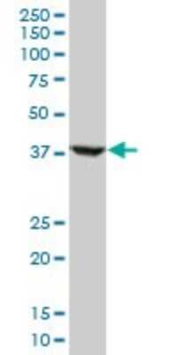 Western Blot: RNF2 Antibody (2B6) [H00006045-M05]