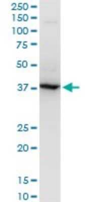 Western Blot: RNF2 Antibody (2B6) [H00006045-M05]