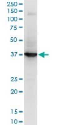 Western Blot: RNF2 Antibody (2B6) [H00006045-M05]