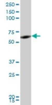 Western Blot: RNF2 Antibody (2B6) [H00006045-M05]